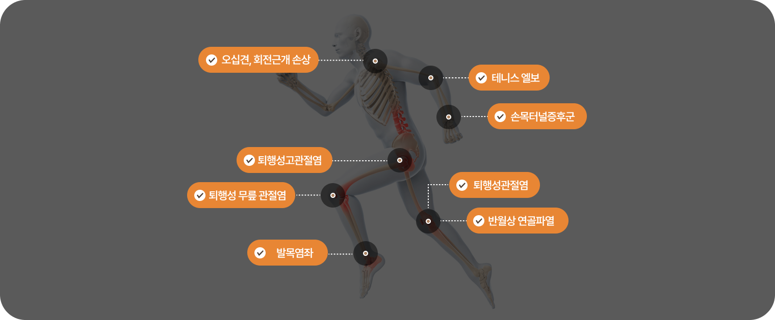오십견,회전근개 손상/테니스 엘보/손목터널증후군/퇴행성고관절염/퇴행성 무릎 관절염/퇴행성관절염/반월상 연골파열/발목염좌